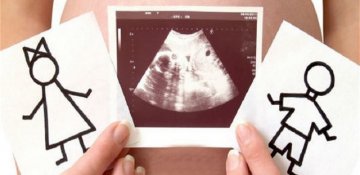 Qız olduğu üçün abort edilən uşaq sayına görə birinci yerdəyik